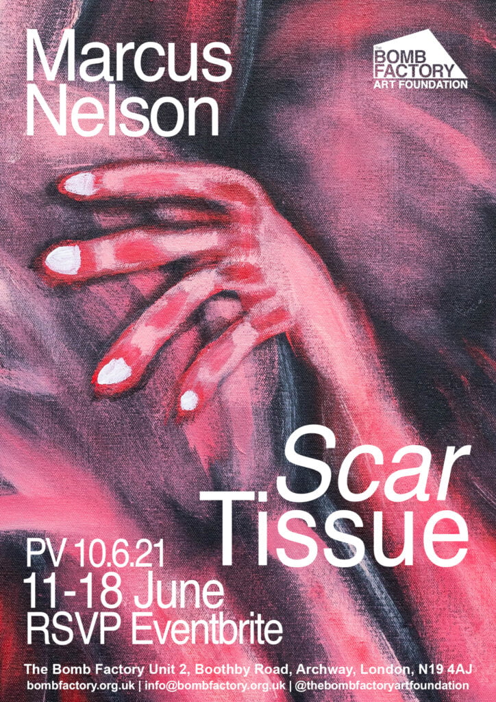 Marcus Nelson: Scar Tissue